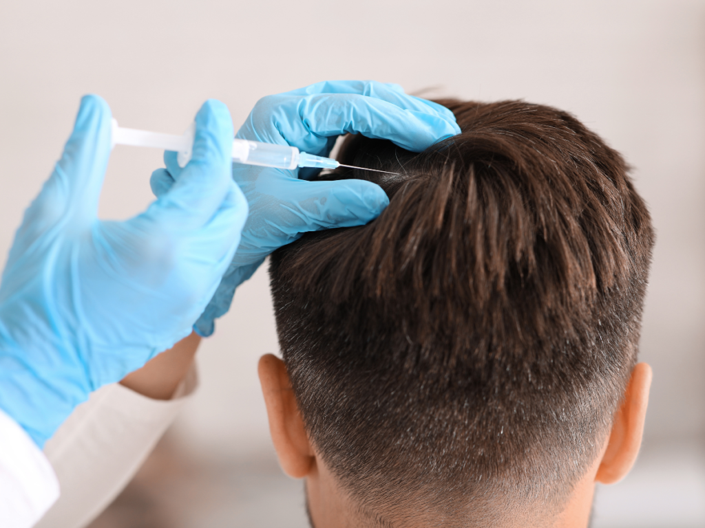 Platelet-rich plasma hair treatment performed by provider