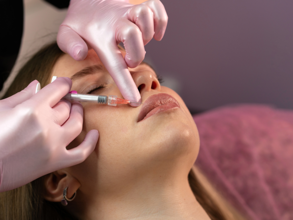 Professional lip augmentation using dermal fillers